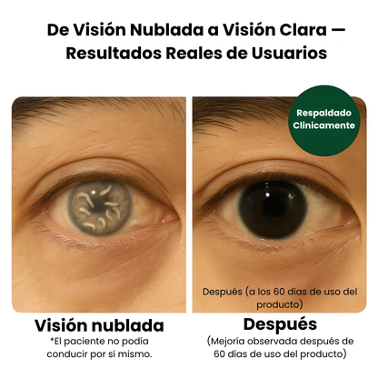 EverVision  - El poder natural detrás de una visión saludable
